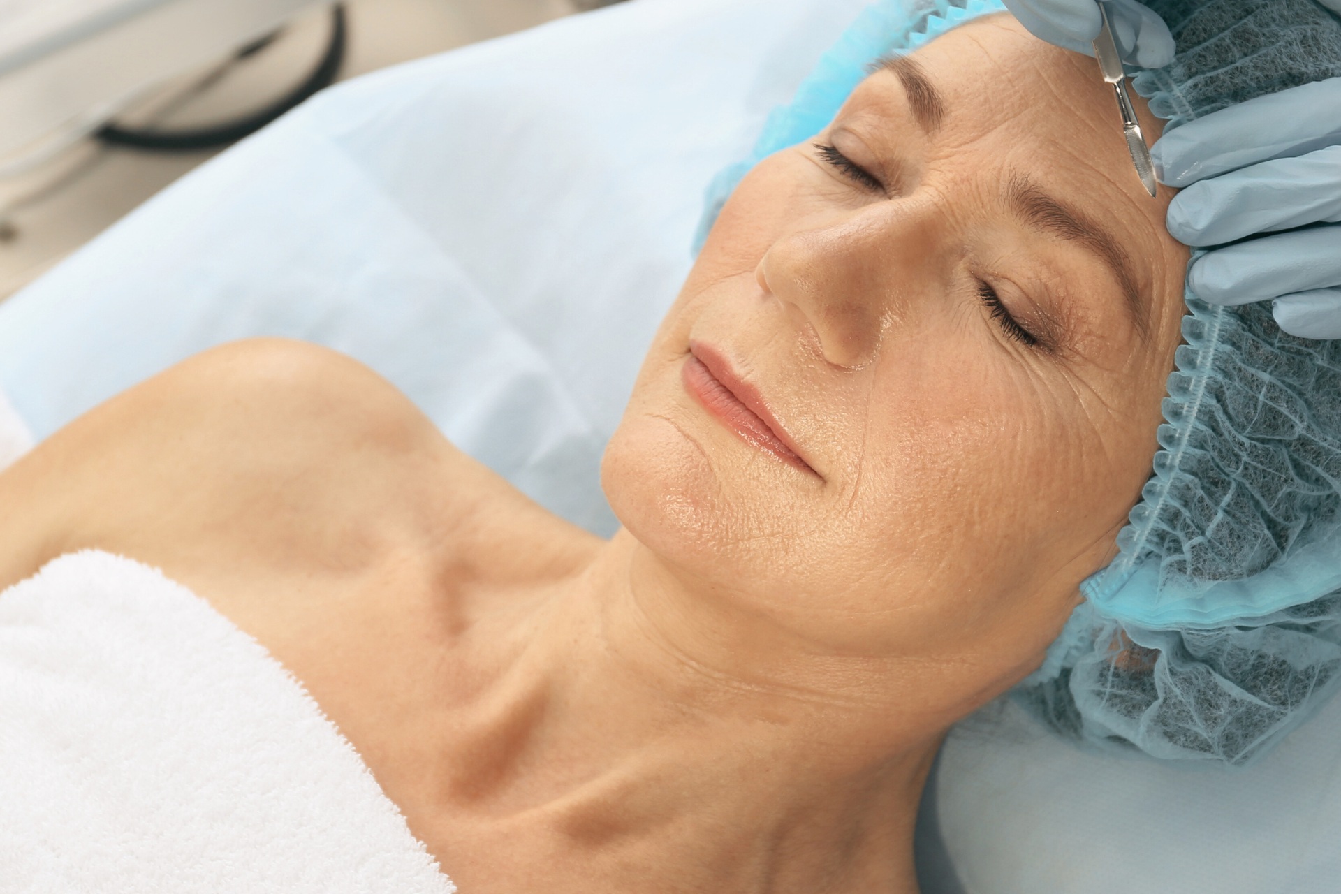 Brow lift - lifting brwi