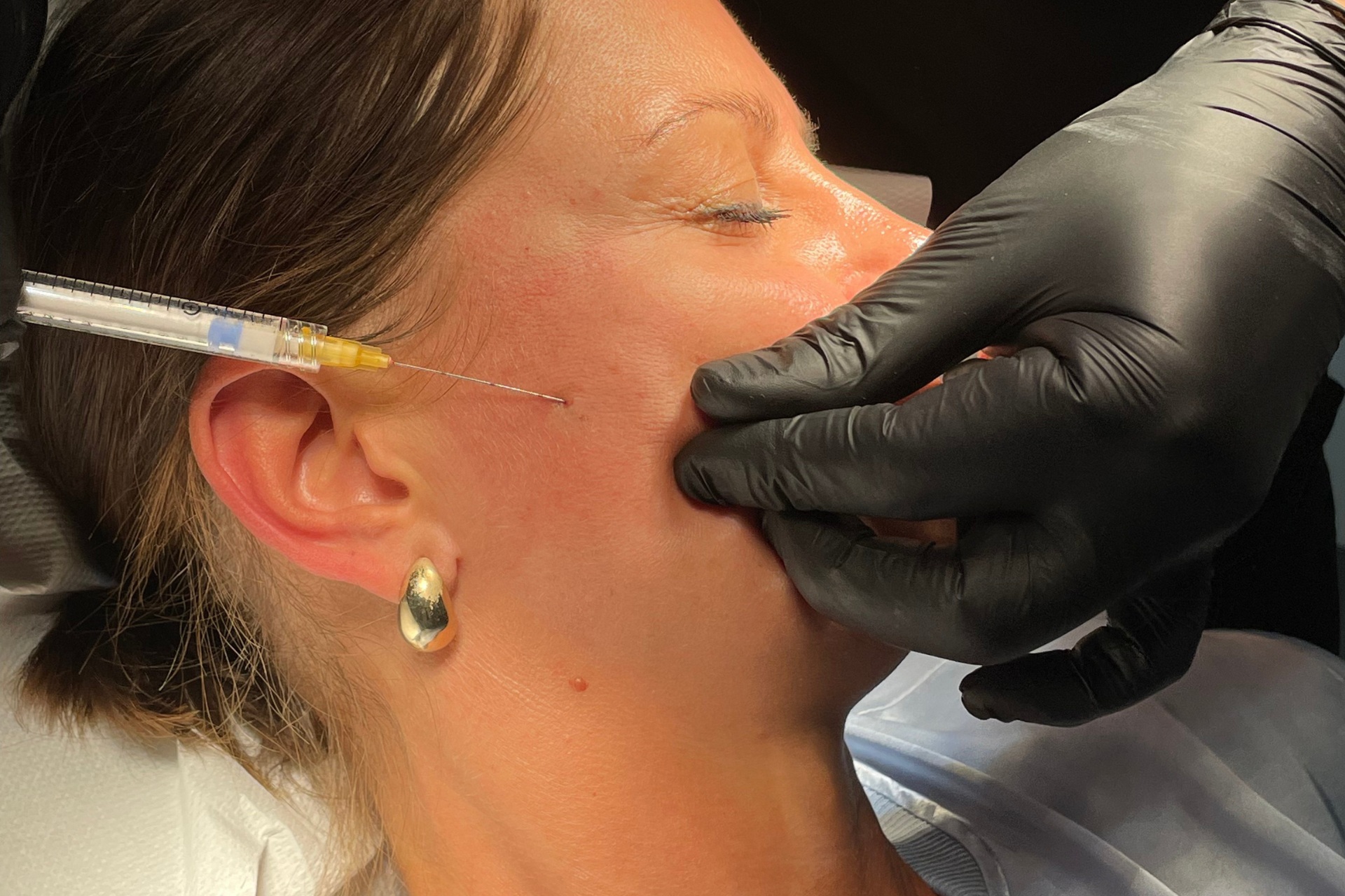Sculptra / JuveLook / Lenisna
