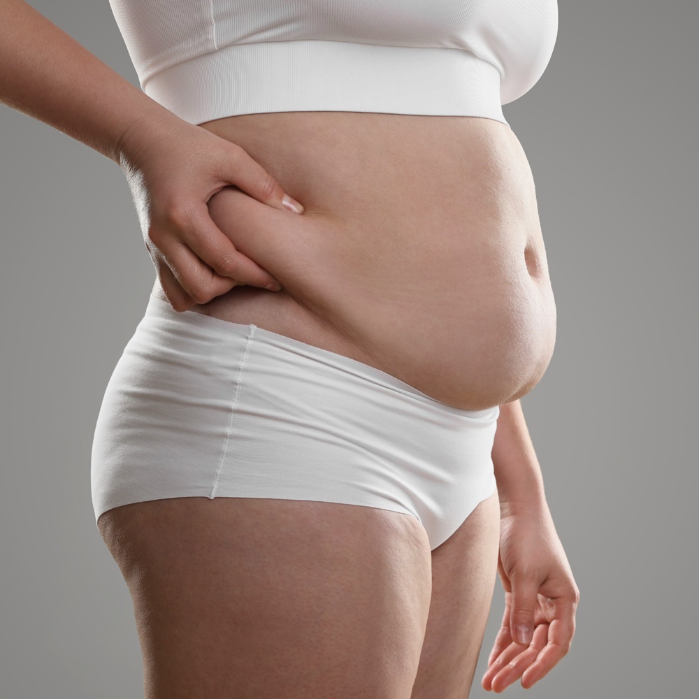 Lipotransfer Łódź - zabieg