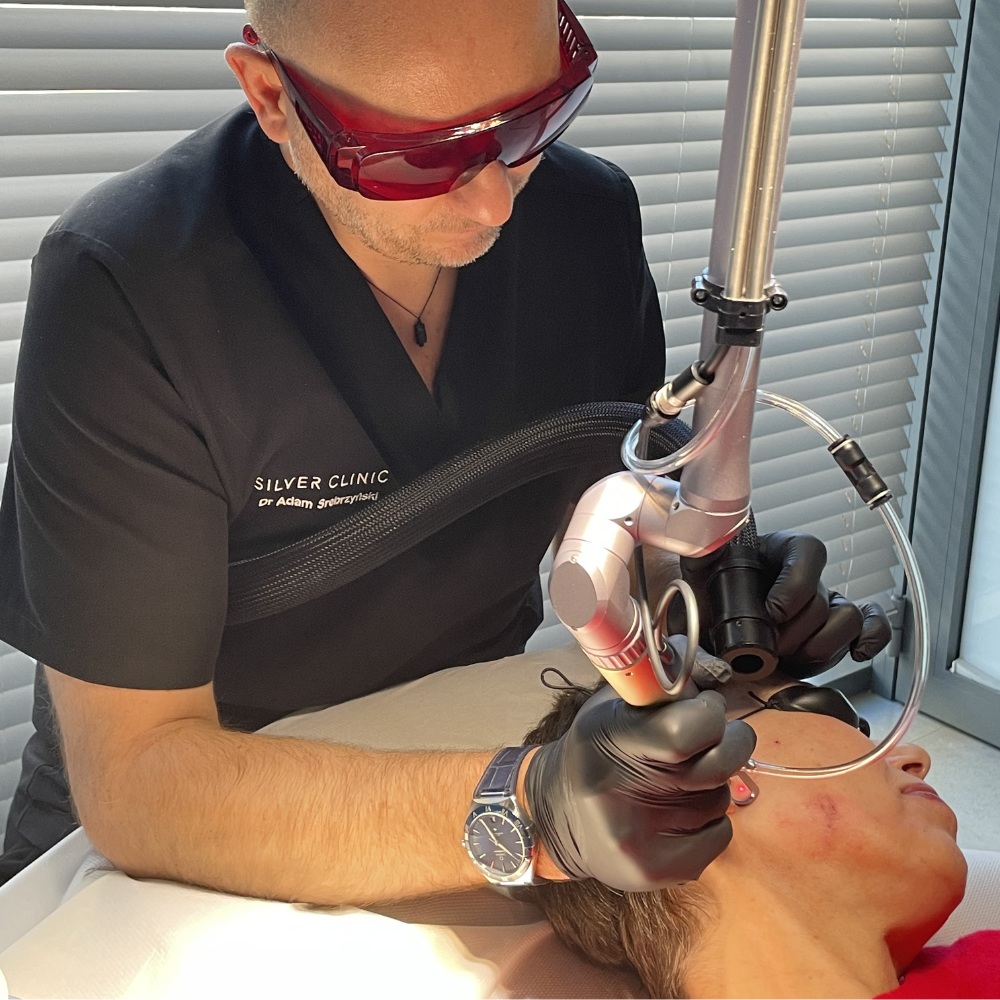 Zabieg Laser pikosekundowy Łódź - SILVER Clinic